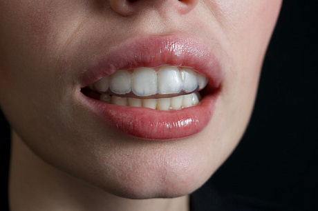 Капа для хоккея, регби и баскетбола